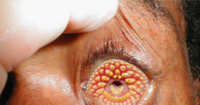You Won't Believe These Terrifying People are Real