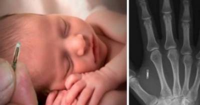Reports Say That The Government Has Been Microchipping Babies Since 1983!