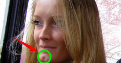If You Have This Hole On Your Chin You Are Really Special! Here&rsquo;s What It Says About You