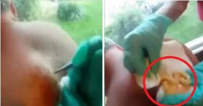 This Man Wants To Get Rid Of The Lump On His Back. But When She Pricks It, Everything Comes Flying At Her.