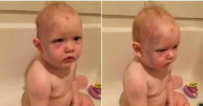 The Babysitter Who Abused This 1-Year-Old Isn't Being Charged For The Dumbest Reason