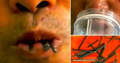 Man Swallows EIGHT Six-Inch Nails In Ridiculous &lsquo;Party Trick&rsquo;