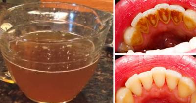 This Natural Tea Removes Plaque Better Than Commercial Mouthwash