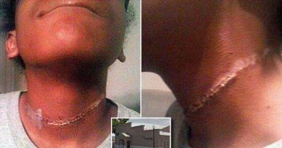 3 White Students Tried to Lynch Black 12 Year Old Girl On Camping Trip
