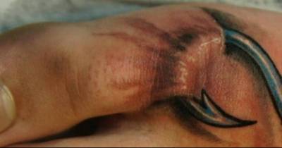 When The Parents See Their Daughter Like This, They Have A Nervous Breakdown. Her Body Will Look Like This Forever.