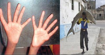 These Not So Ordinary Pictures Will Make You Very Uncomfortable