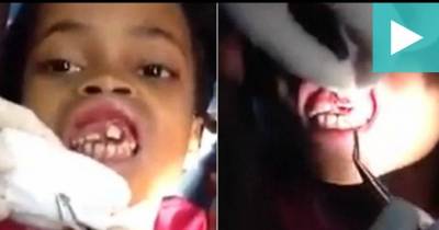 Girl Felt Odd 'Tingling' In Her Mouth. Dentists Had To Film What Came Out Of It