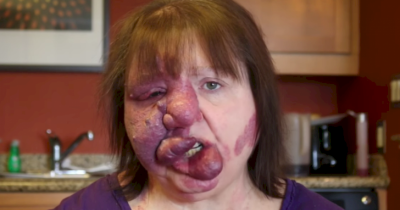 This Mom With A Rare Syndrome Teaches Us A Lot About What Beauty Really Means