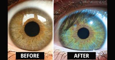How Raw Food Diet Changed This Woman&rsquo;s Eye Color