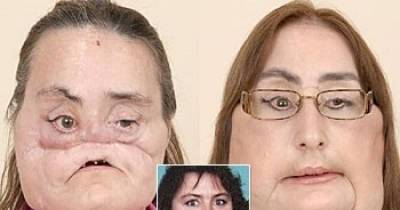 These Incredibly Successful Medical Surgeries Will Make You Believe In Science!