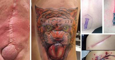 These Tattoo Concepts Cover Scars From The Past