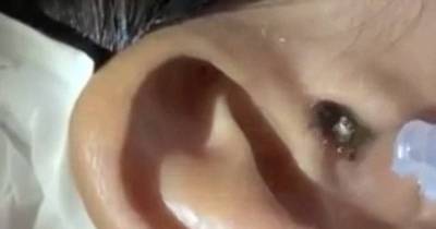 Horrifying Video Shows Spider Being Flushed Out Of Man's Ear After It Crawled Inside Whilst He Was Sleeping