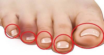 Touch The End Of Your Toes And You Will Know If There&rsquo;s A Heart Problem Or Not