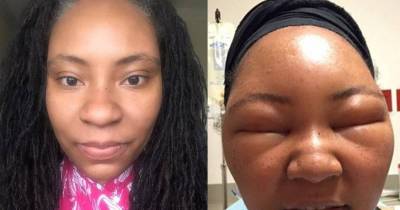 Woman Gets Her Gray Hair Dyed With Horrifying Results.