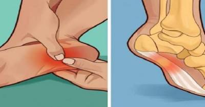 Does Your Heel Hurt in the Morning or Whenever You Stand Up? Here&rsquo;s What You Need to