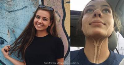 She Cried After Spray Tan And The Result Was Disastrous