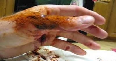 How To Stop Serious Bleeding In Just 10 Seconds!