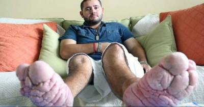 This Guy's Bizarre Genetic Condition Will Leave You In Tears