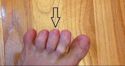 He Begs His Friends To Check Between Their Toes. The Reason Saved His Life And It Can Save Yours Too.