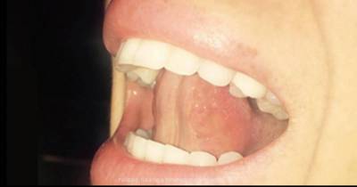 If You Touch The Roof Of Your Mouth With Your Tongue And Breathe, THIS Happens To Your Body!