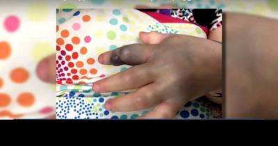 Her Daughter Came Inside Screaming. When Her Mom Sees Her Hand? Pure Panic. But The Cause? YIKES!