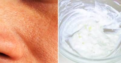 Remove Large, Oily Pores FAST with these Natural Ingredients