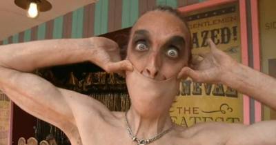Unbelievable! Meet The Man With The Stretchiest Skin In The World