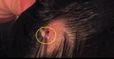 She Had An Itchy Scalp. When They Discovered Why, I Was Appalled