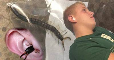 Teen Pulls Out 4 Inch Centipede From His Ear After He Woke Up In Excruciating Pain