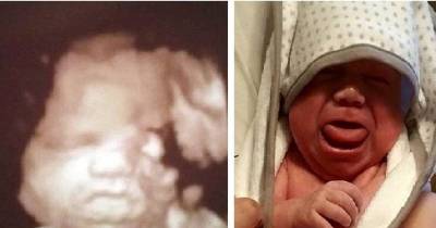 They Panicked When They Saw The Ultrasound - It Was Something Life-threatening.