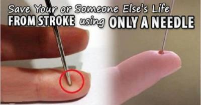 This Is Why You Should Always Have A Needle In Your Pocket