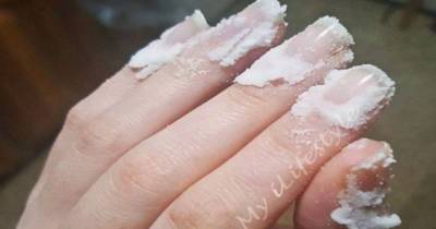 Rub Some Baking Soda On Your Nails And Watch What Happens!