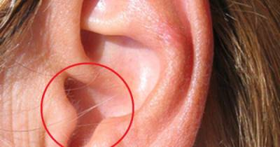 Having Hair In Your Ear Is A Warning Sign! What Does It Mean?