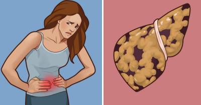 Ways To Tell If You Have A Fatty Liver And What To Do Next