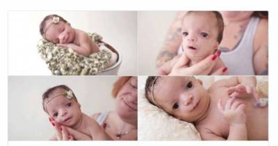 The Shocked Adoptive Mother Ran Out Of The Nursery Crying. She Found Her Baby&rsquo;s Face Startling.