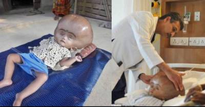 He Found This Baby In A Poor Village But Wait Till You See Her Face 2 Years Later