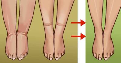 Ways To Deal With Bloating From Water Weight Gain