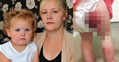 Toddler Rides Down Slide At The Park. When She Stands Up, Mom Sees Blood