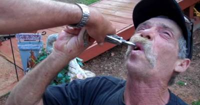 Redneck Dentist: East Texas Tooth Extraction