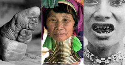 The Most Extreme Body Modifications Throughout History