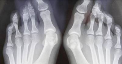 Here's Why Women Should Stop Wearing High Heels