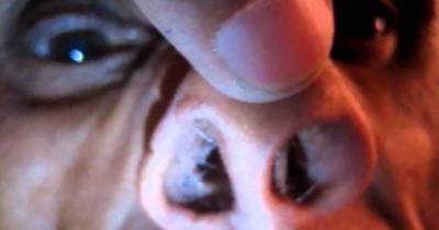 What This Doctor Found In His Patient&rsquo;s Nose Will Make You Feel Terrified!