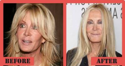 15 Once Beautiful Celebrities Who Ruined Their Own Looks