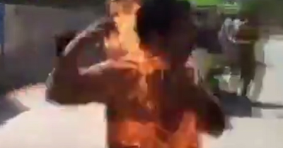 Shocking: Man Engulfed In Flames Until Someone Put Him Out After Mobile Phone Battery Catches Fire In His Pocket