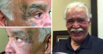 Seeing How This Guy's Mask Of Blackheads Gets Cleared Away Is Proof That Popping Videos Help