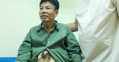 This Octoman Story Will Make You Feel How Lucky You Are!