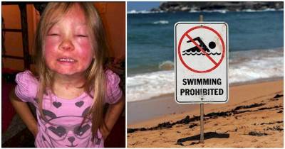 6 Year Old Went Swimming In The Ocean And Came Out With A Skin Infection