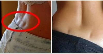 People Are Making Outrageous Claims About Back Dimples... Seriously?!?