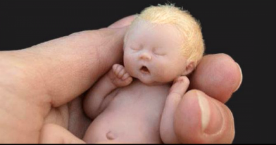 This Baby Is So Small It Fits In The Palms Of Her Hand. But When You Look Closer? I&rsquo;m Speechless.