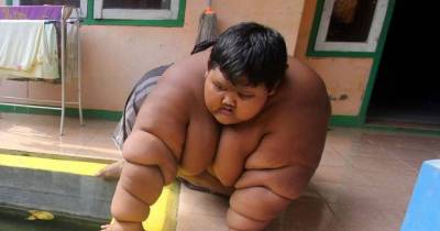 World&rsquo;s Fattest Child, 10, Put On Crash Diet To Save His Life